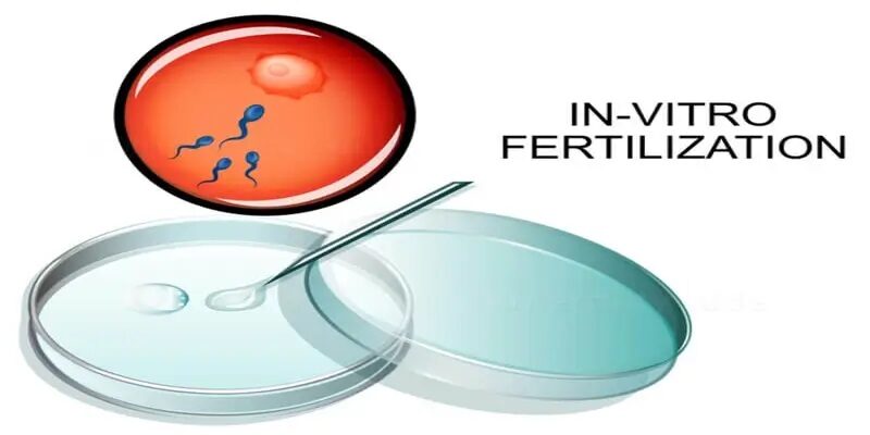 What is In Vitro Fertilization