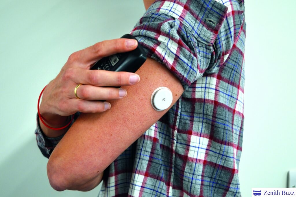 Continuous Glucose Monitoring: Everything You Should Know - ZenithBuzz