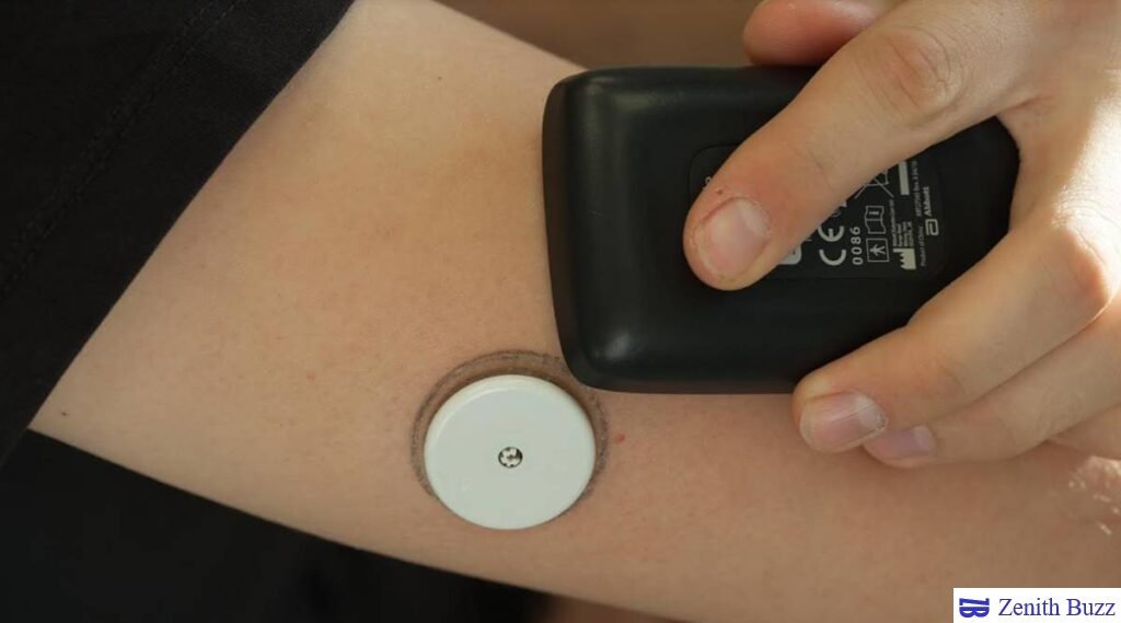 Diabetes Care - Easy Glucose Monitoring With CGM - ZenithBuzz